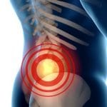 Чи можна вилікувати протрузію та грижу без операції?