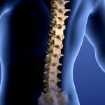 Протрузія міжхребцевого диска: як виникає і чому не варто затягувати з лікуванням